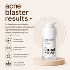 ACNE BLASTER